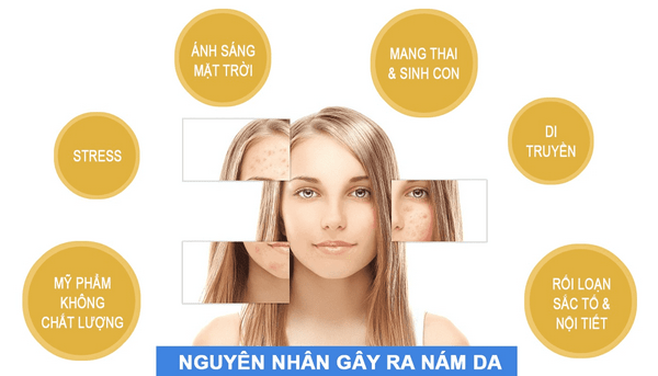 Nguyen-nhan-gay-ra-nam-va-cach-cham-soc-da-mat-bi-nam
