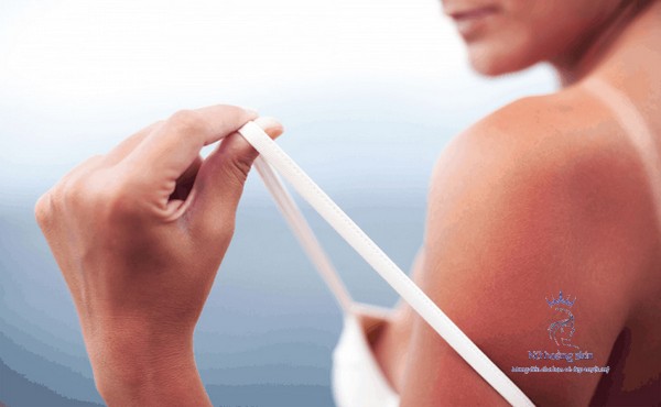 Tia UV góp phần quan trọng trong việc gây bệnh ung thư da